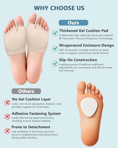 Comparison of two pairs of beige metatarsal sleeves in large size.