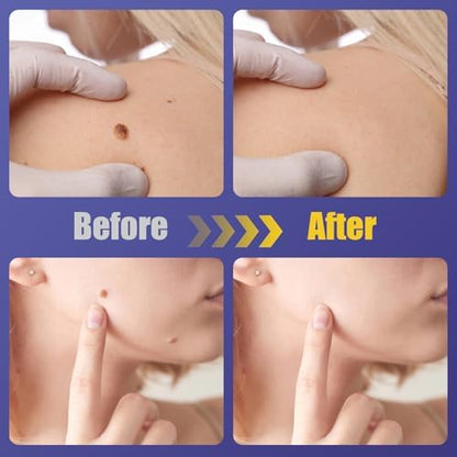 Infographic showing the botanical ingredients and healing process of hydrocolloid dots.