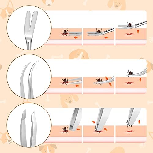 Rypet tick remover kit packaging contents