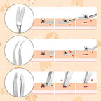 Rypet tick remover kit packaging contents