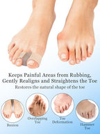 PGRODE gel toe spacers applied to feet demonstrating proper alignment between the big toe and second toe.