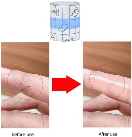 DeaHea protective skin patches roll detailing the five by five hundred centimeters dimensions.