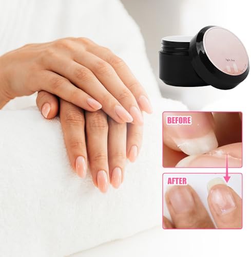Before and after comparison of a severe side nail split fixed with clear protective gel