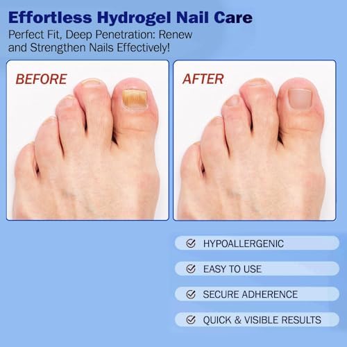 Boxania anti fungal solution patches before and after comparison showing clear nail progression