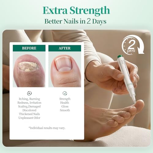 Day and night antifungal pen set for 24 hour nail repair.