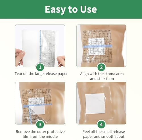Hands free medical shower cover for urostomy appliances close up detail