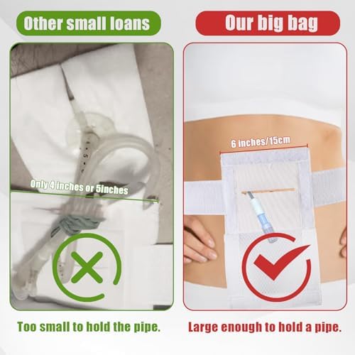 White feeding tube accessory pack of two