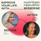 Supplement facts panel on Nutrition Republic Berberine and Dihydroberberine bottle detailing exact milligram dosages.