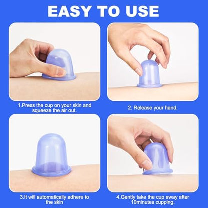 Blue silicone massage cups being squeezed for vacuum therapy application.