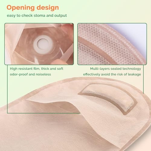 Greetmed drainable stoma pouch hook and loop closure detail