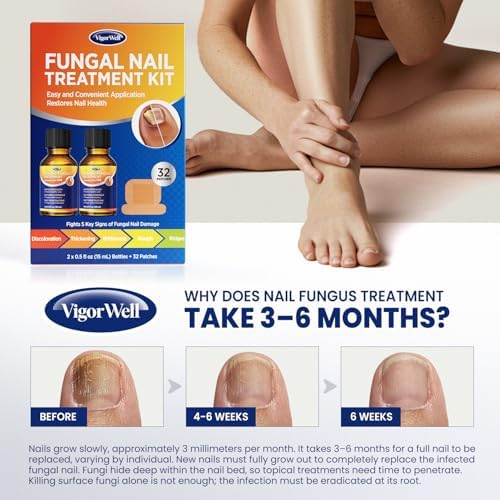 VigorWell extra strength kit components demonstrating the morning and night application routine for feet.