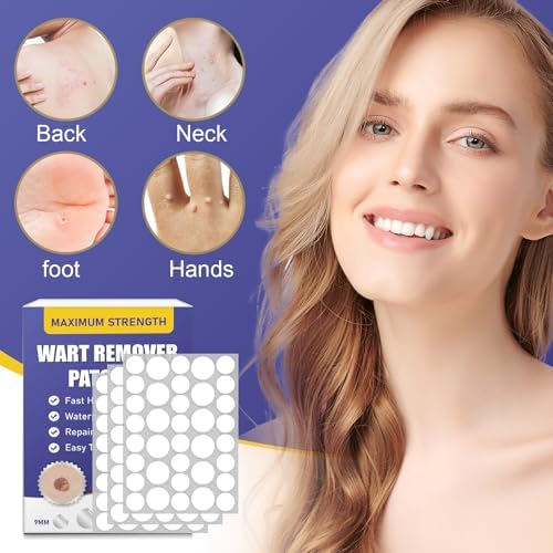 Detailed application guide showing how to place the hydrocolloid patch on a common wart.