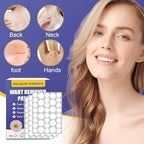 Detailed application guide showing how to place the hydrocolloid patch on a common wart.
