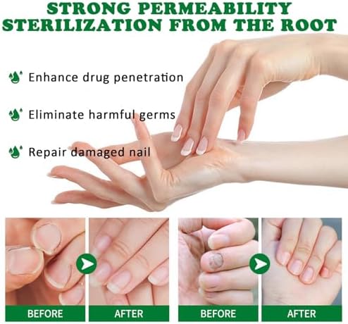 LOYOTICE professional nail care products works to provide assistance with long nails