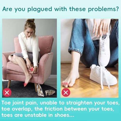 Byehambuni gel toe splints for correcting crooked and claw toes