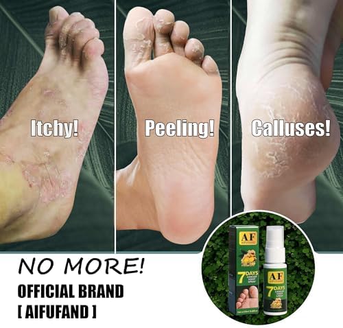 Natural ginger formula spray for athlete's foot and itching relief.