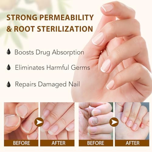 Vitamash 60ml nail growth serum label and ingredients detail