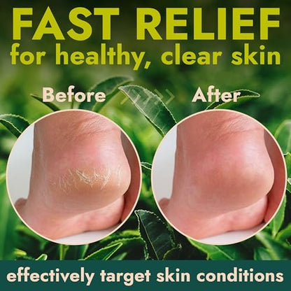 Terramed foot treatment kit packaging for professional at home pedicure results.