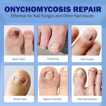 Hygienic application steps for the boxania brittle nail correction system