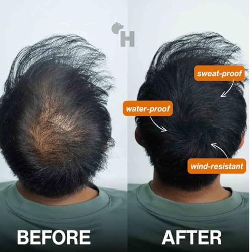 Waterproof hair building fibers being applied to thinning crown area
