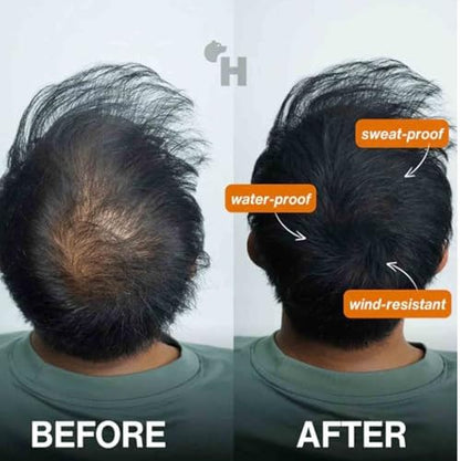 Waterproof hair building fibers being applied to thinning crown area
