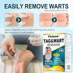 Authentic USA imported Compound W skin care treatment for warts and skin growths