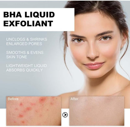Ingredient label detail for Paula's Choice salicylic acid exfoliant
