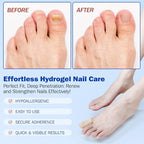WLCTJIAYOU 8-hour intensive nail renewal treatment packaging for men and women.