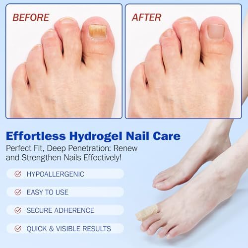 Demonstration of the 8 hour secure adherence on a fingernail for overnight care.