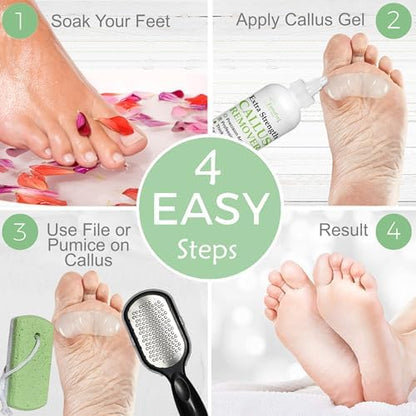 Complete EntreFeet pedicure set showing bottle and all exfoliating tools.