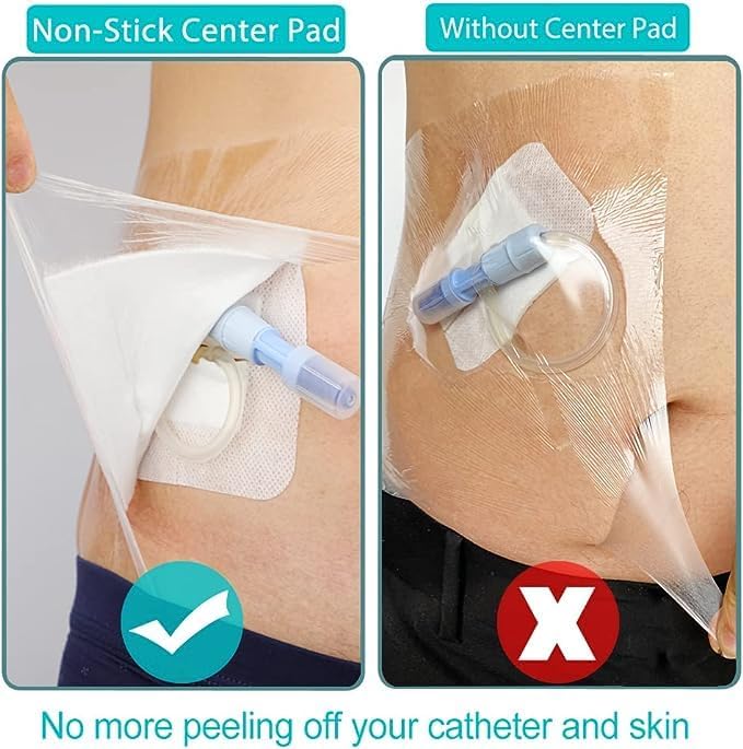GoToHere transparent dressing shield acting as a second skin water barrier for large medical incisions.