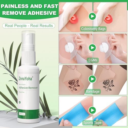 ZnnaYoha 4 ounce medical adhesive remover for ostomy care
