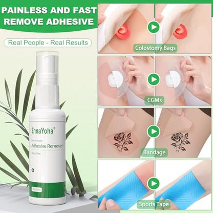 ZnnaYoha 4 ounce medical adhesive remover for ostomy care