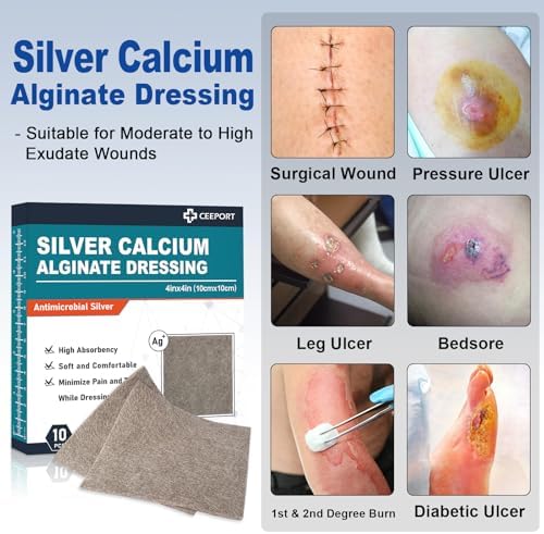 Optiteknik four by four inch silver alginate patches showing highly absorbent texture
