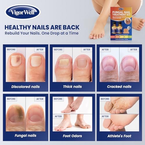 Thirty two medium VigorWell nighttime hydrogel patches displayed for overnight toenail renewal therapy.