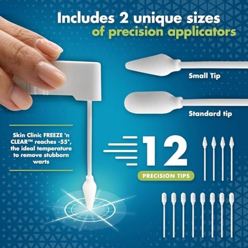 Skin Clinic cryo-freeze canister showing proprietary gas-dispensing technology for common warts.