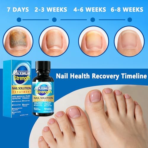 Comparison of damaged yellow nail versus healthy clear nail growth after using fungal treatment.