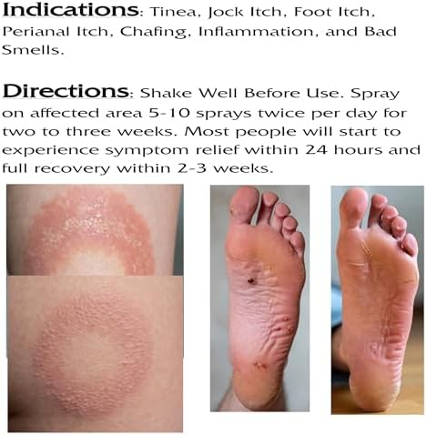 Loyesta maximum strength antifungal spray nozzle close up