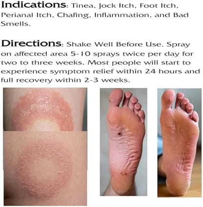Loyesta maximum strength antifungal spray nozzle close up