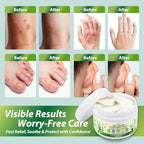 Recuren Plus 100g packaging box highlighting natural ingredients like aloe vera and chamomile.