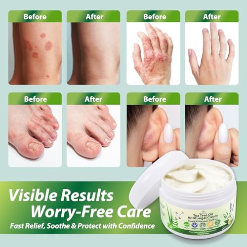 Recuren Plus 100g packaging box highlighting natural ingredients like aloe vera and chamomile.