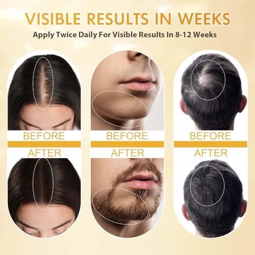 ZYXN minoxidil serum showcasing the clear authentic protective seals