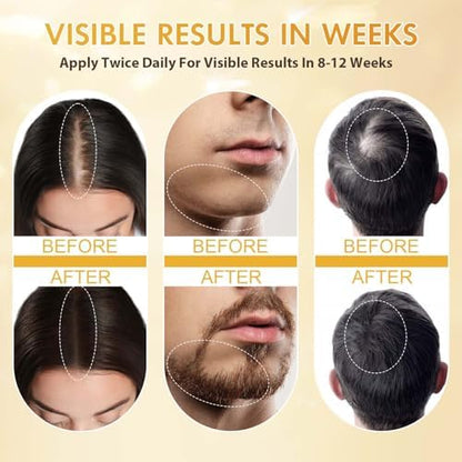 ZYXN minoxidil serum showcasing the clear authentic protective seals