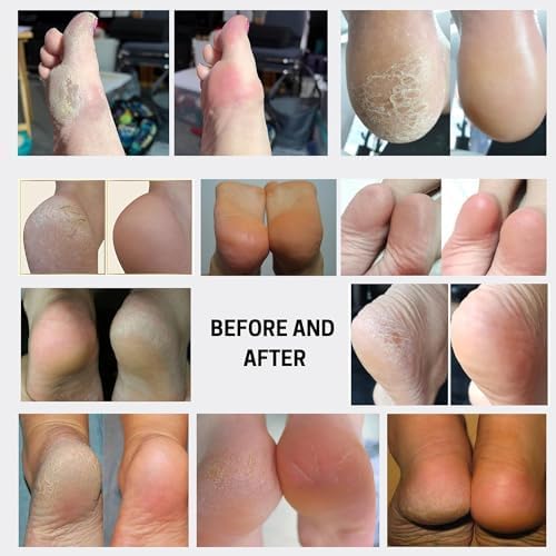 Wonder Pedi exfoliating foot spray bottle 200ml with AHA ingredients