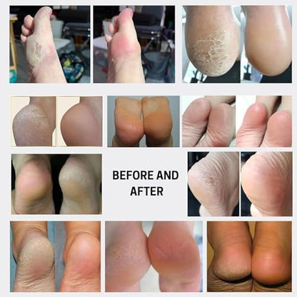 Wonder Pedi exfoliating foot spray bottle 200ml with AHA ingredients