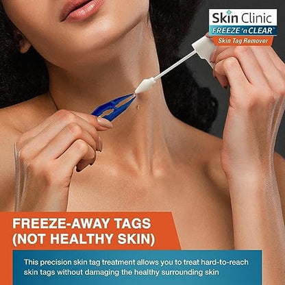Authentic USA imported Skin Clinic Freeze 'n Clear skin tag treatment for Indian customers.