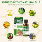 Noxyral nail repair liquid with applicator brush for fungal infections.