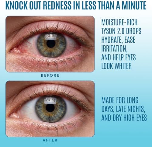 Tyson 2.0 maximum strength lubricant eye drops packaging details.