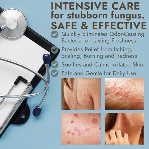 Authentic USA imported Terramed antifungal spray for athlete's foot and ringworm relief
