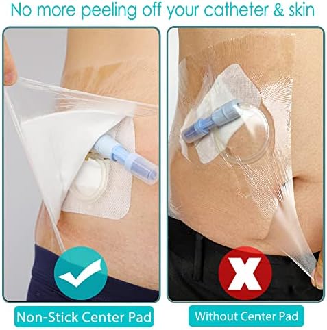 Large ten by twelve inch dialysis catheter cover showing non stick center pad